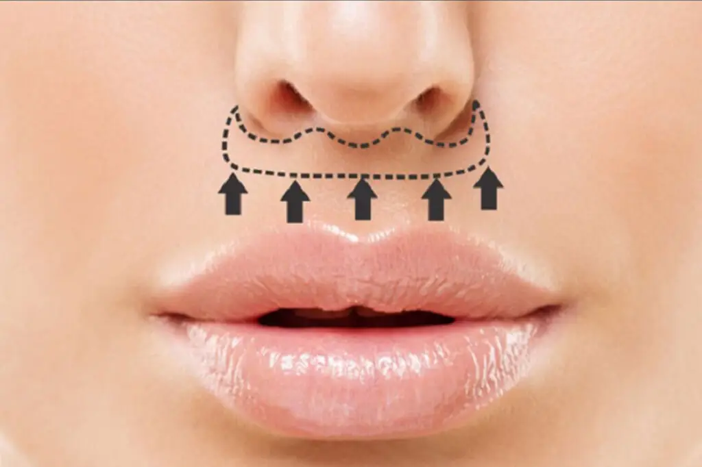liplift-atelierbeleza.pt
