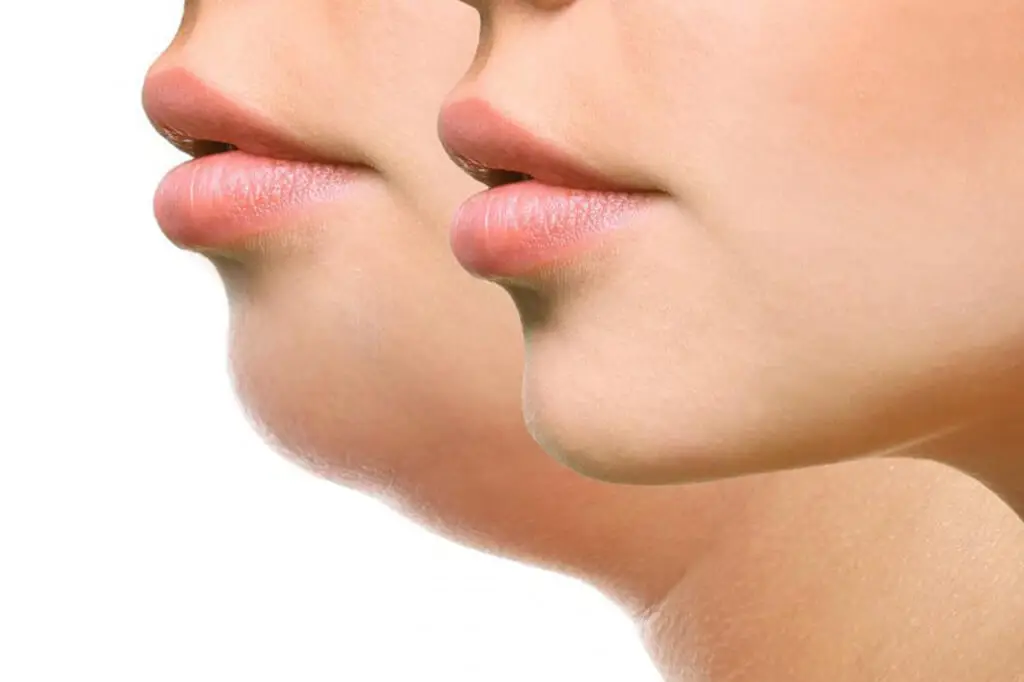 tratamento-papada-atelierbeleza.pt